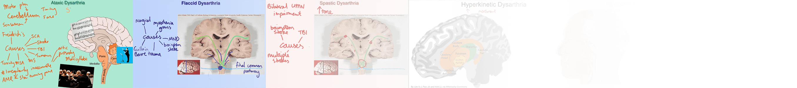 thumbnails of dysarthria tutorial videos